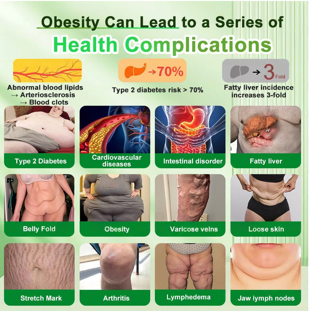 New Arrival 💧| 𝐁𝐧𝐨𝐝𝐨® 𝗚𝗟𝗣-𝟭 𝟐𝟎-𝐢𝐧-𝟏 𝐒𝐥𝐢𝐦& 𝑯𝒆𝒂𝒍𝒕𝒉𝐲 𝑶𝒓𝒂𝒍 𝑺𝒐𝒍𝒖𝒕𝒊𝒐𝒏 𝑂𝑛𝑐𝑒 𝑎 𝑑𝑎𝑦, 𝑣𝑖𝑠𝑖𝑏𝑙𝑒 𝑟𝑒𝑠𝑢𝑙𝑡𝑠 𝑖𝑛 7 𝑑𝑎𝑦𝑠  ✅ 𝗦𝘂𝗽𝗽𝗼𝗿𝘁𝘀 𝗼𝗯𝗲𝘀𝗶𝘁𝘆, 𝗰𝗮𝗿𝗱𝗶𝗼𝘃𝗮𝘀𝗰𝘂𝗹𝗮𝗿 𝗵𝗲𝗮𝗹𝘁𝗵, 𝗱𝗶𝗮𝗯𝗲𝘁𝗲𝘀, 𝘀𝗹𝗲𝗲𝗽 𝗮𝗽𝗻𝗲𝗮, 𝗴𝘂𝘁 𝗵𝗲𝗮𝗹𝘁𝗵, 𝗷𝗼𝗶𝗻𝘁 𝗶𝘀𝘀𝘂𝗲𝘀, 𝐰𝐡𝐢𝐥𝐞 𝐚𝐥𝐬𝐨 𝐟𝐢𝐫𝐦𝐢𝐧𝐠 𝐭𝐡𝐞 𝐬𝐤𝐢𝐧 𝐚𝐧𝐝 𝐛𝐨𝐨𝐬𝐭𝐢𝐧𝐠 𝐞𝐧𝐞𝐫𝐠𝐲.