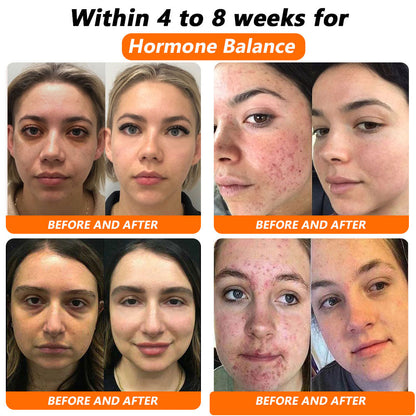 💐𝐂𝐯𝐫𝐞𝐨𝐳® 𝐁𝐞𝐞 𝐕𝐞𝐧𝐨𝐦 𝐍𝐌𝐍 𝐍𝐚𝐭𝐮𝐫𝐚𝐥 𝐑𝐞𝐩𝐚𝐢𝐫 𝐕𝐚𝐠𝐢𝐧𝐚𝐥 𝐂𝐚𝐩𝐬𝐮𝐥𝐞𝐬 [𝐅𝐨𝐫 𝐚𝐥𝐥 𝐯𝐚𝐠𝐢𝐧𝐚𝐥 𝐚𝐧𝐝 𝐡𝐨𝐫𝐦𝐨𝐧𝐚𝐥 𝐩𝐫𝐨𝐛𝐥𝐞𝐦𝐬]